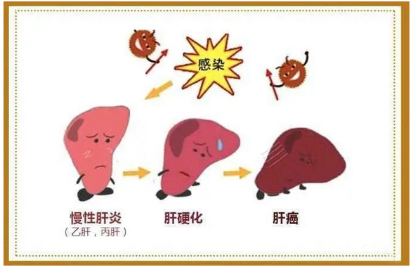 干细胞治疗乙肝大三阳和小三阳